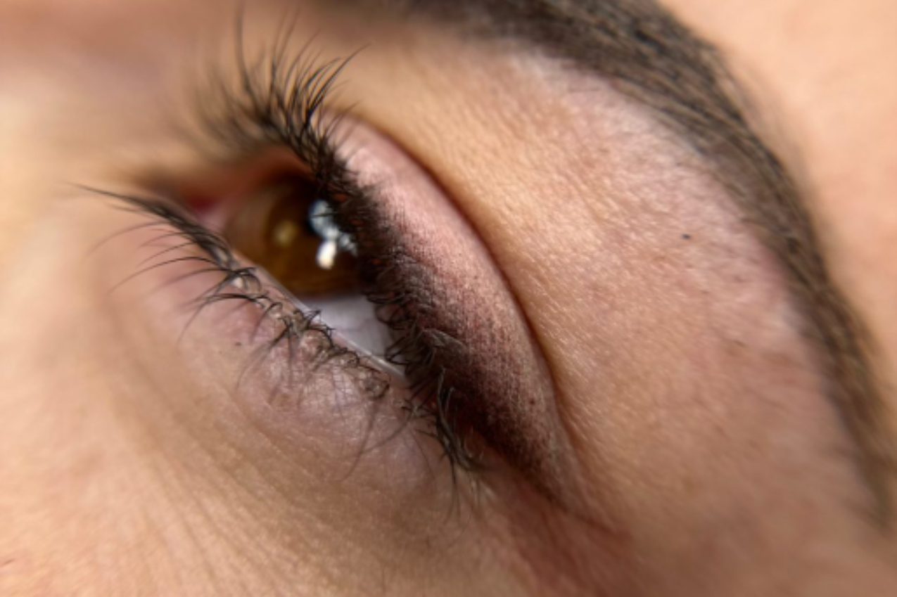 J&eacute;ssica Jim&eacute;nez - Medical & Beauty Tattoo 11