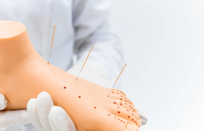 Acupuntura vital majadahonda 7