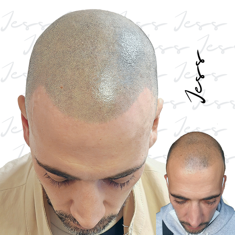 Jess Microcapilar 13