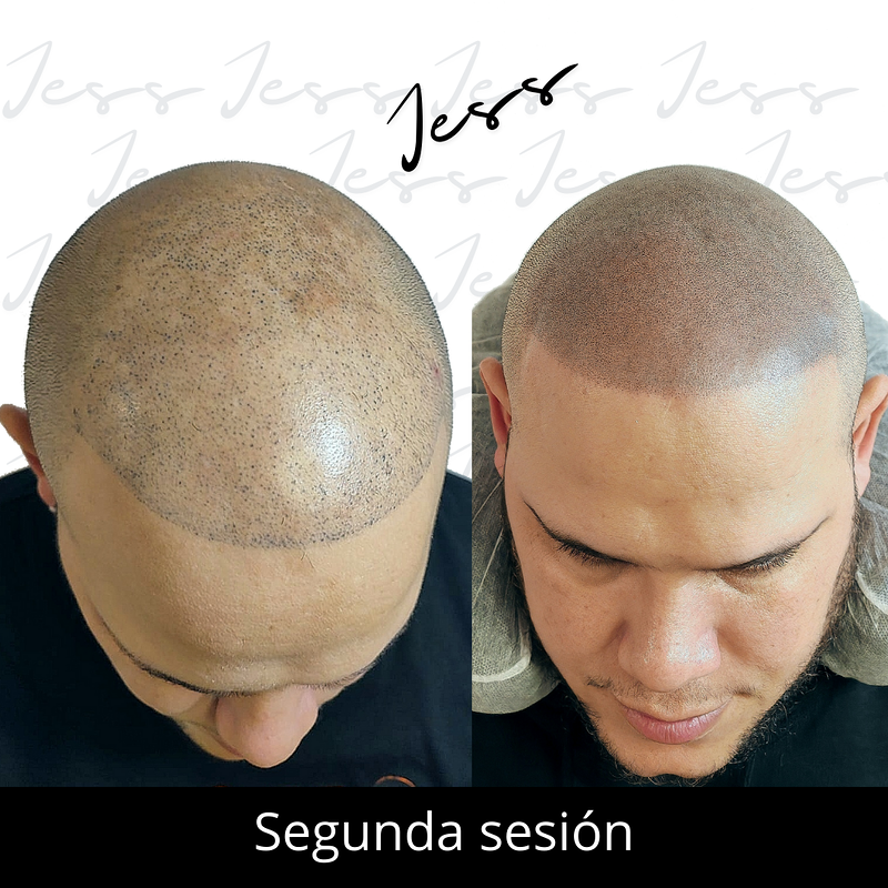 Jess Microcapilar MICROPIGMENTACION (MAQUILLAJE PERMANENTE): SERVICIOS