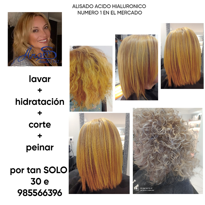 Arans Depilación Laser en Avilés 7