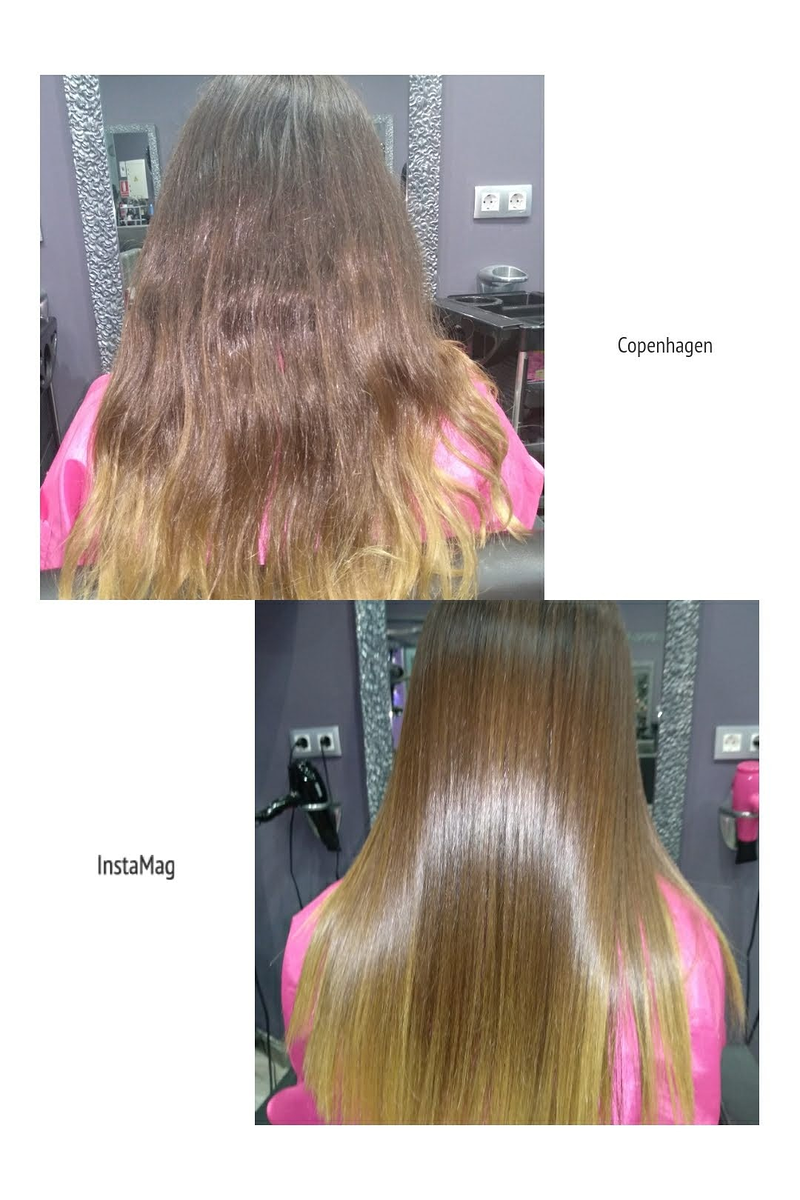 Arans Depilación Laser en Avilés 13