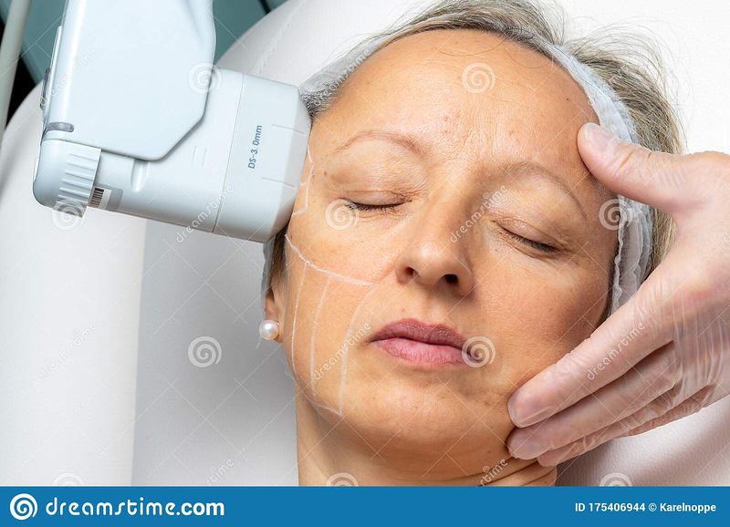 Arans Depilación Laser en Avilés 15