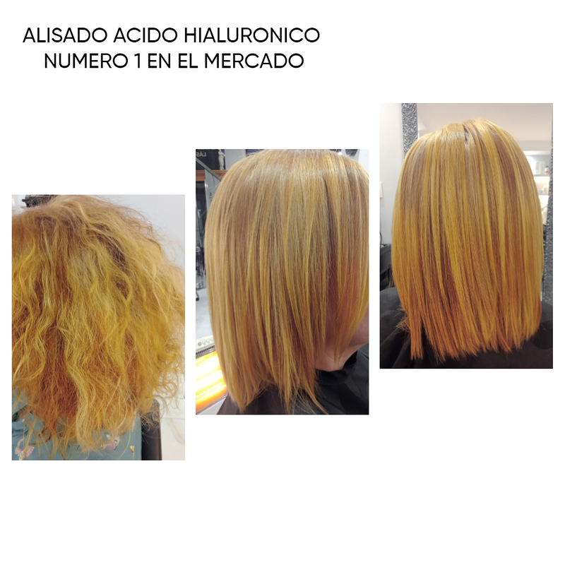 Arans Depilación Laser en Avilés 27