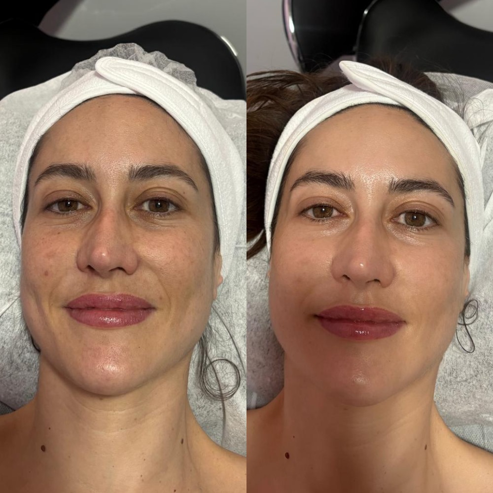 Galería de imágenes