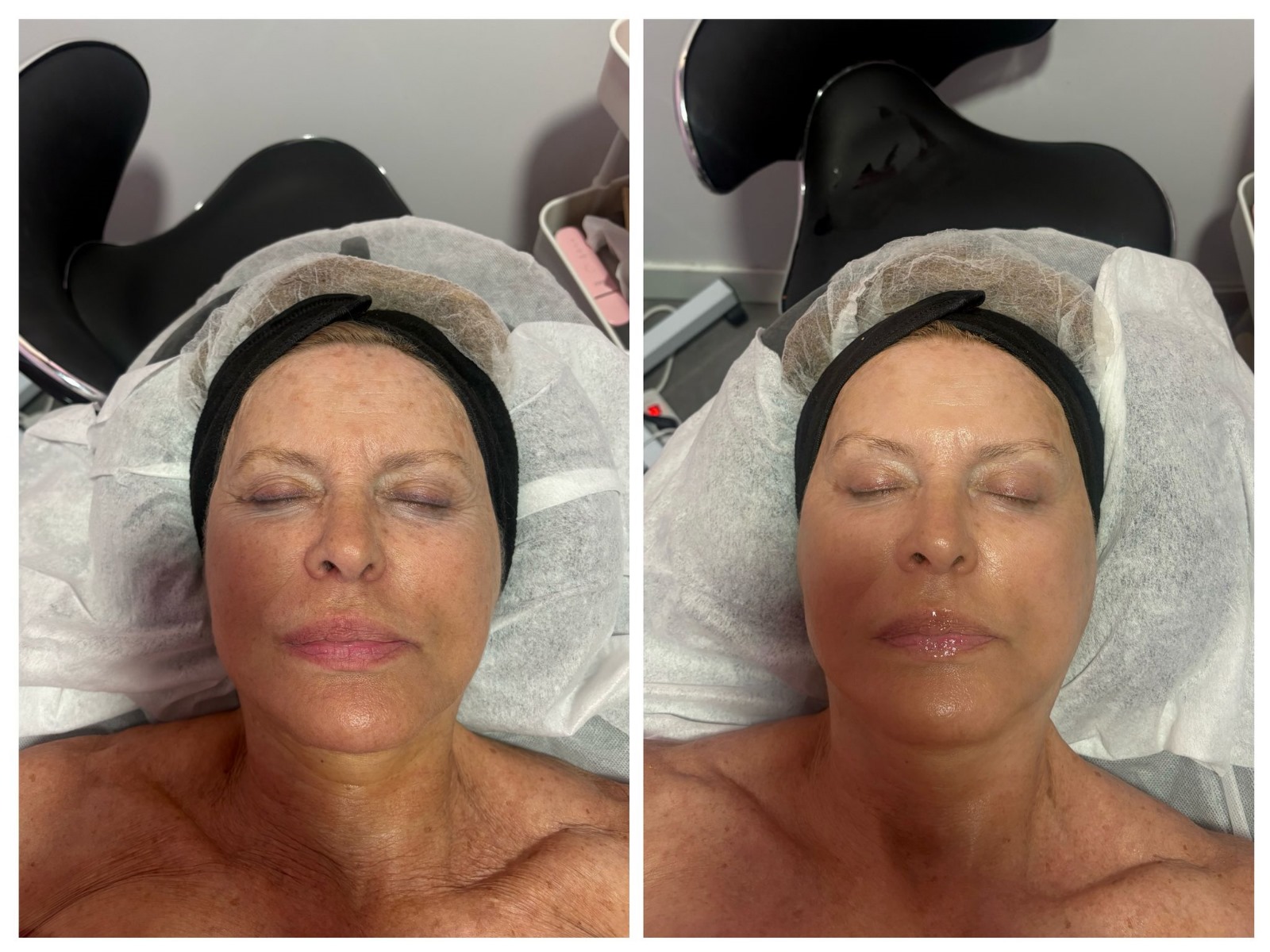 Galería de imágenes