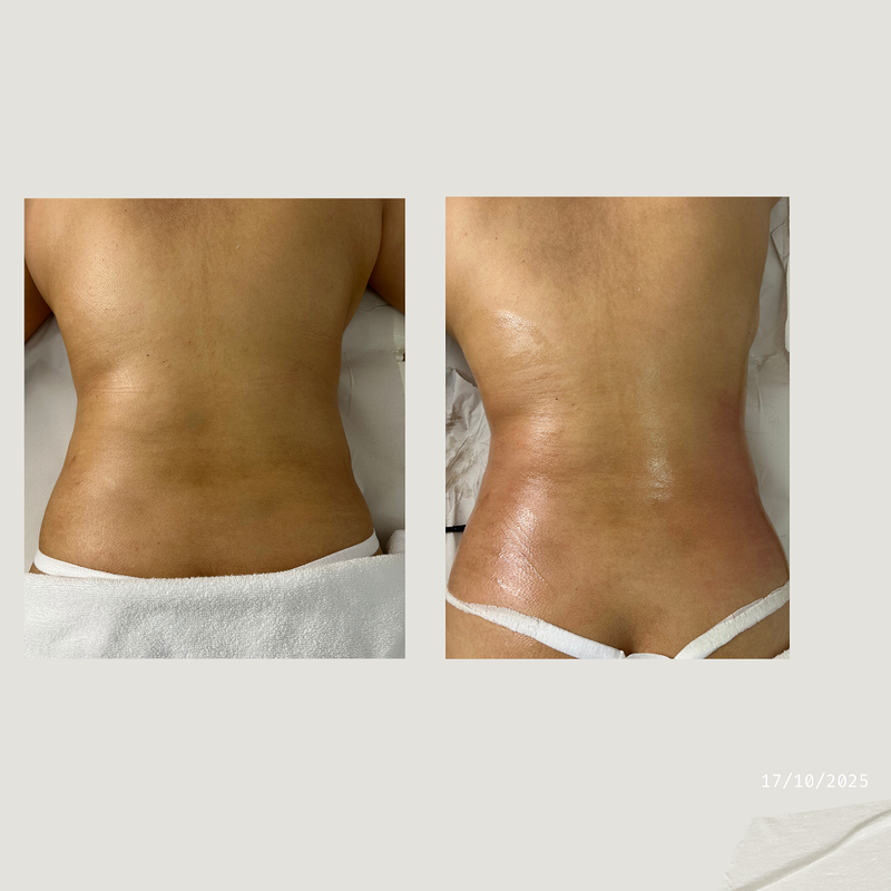 FNASS Tendencia Est&eacute;tica 6