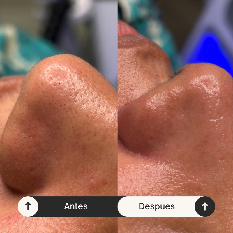 FNASS Tendencia Est&eacute;tica Vitoria-Gasteiz