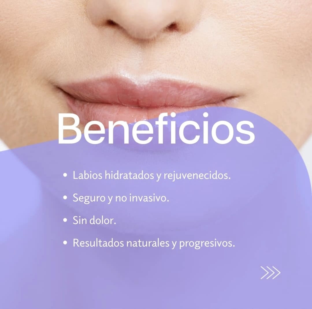 Galería de imágenes