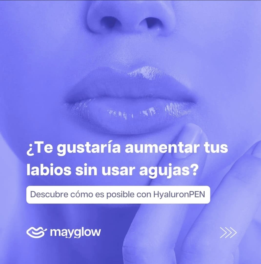 Galería de imágenes