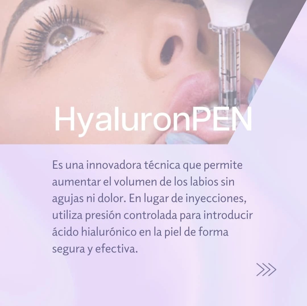 Galería de imágenes