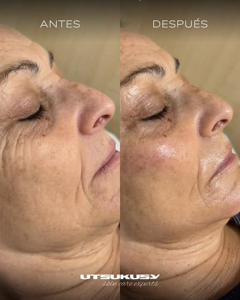 Isa Martín Láser y Estética BIENESTAR Y BELLEZA: CENTROS