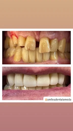 Cl&iacute;nica SmilesDent Alameda CLINICAS DENTALES