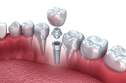 Centros Odontológicos Doctores Sabras CLÍNICAS DENTALES Centros Odontológicos Doctores Sabras CLÍNICAS DENTALES
