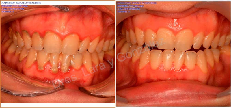 Clinica dental Lara y González La Solana