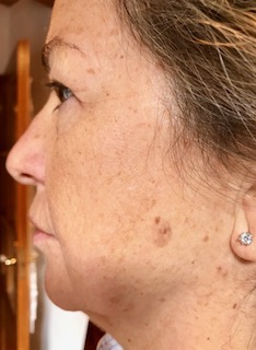 Centro Dermatológico Dr. Javier Bassas Bresca 2 Centro Dermatológico Dr. Javier Bassas Bresca 2