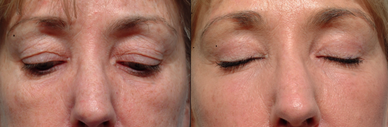 Cl&iacute;nica Vicario 6