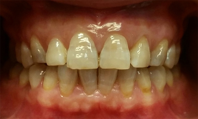 Clínica Dental Tarrés CLINICAS DENTALES