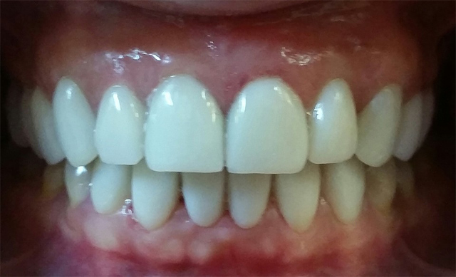 Clínica Dental Tarrés Terrassa