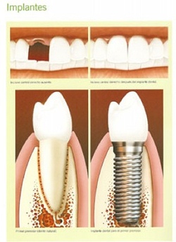 Clínica Dental Dr. Bordes Lleida 4 Clínica Dental Dr. Bordes Lleida 4