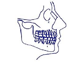 Consulta Forteza - Rey